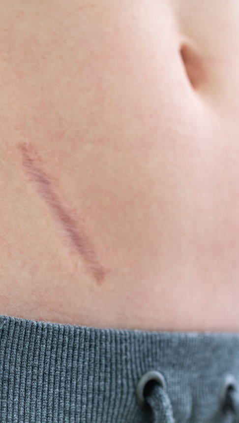 Scarguard Scar Repair Liquid – Scarguard Labs